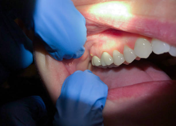 Best Walk-In Emergency Dentist in River Road, NC